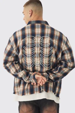boohooMAN Oversized Skeleton Applique Check Shirt | UK| Shirts